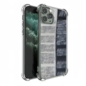 Pros And Cons iPhone11 Pro Phone Case (Silicone)