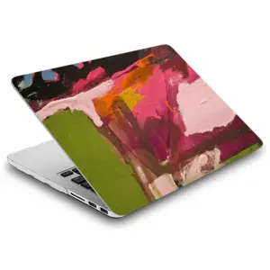 Easy Dream MacBook Pro 13 Case