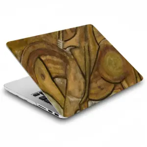 Kichotis MacBook Pro 13 Case