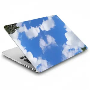 Head In The Clouds MacBook Pro 13 Case