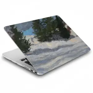 Sunny Day Kyn MacBook Pro 13 Case