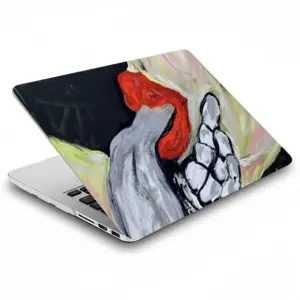 Juviderm Tm 2Ml MacBook Pro 13 Case