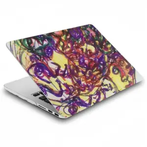 Dizzy MacBook Pro 13 Case