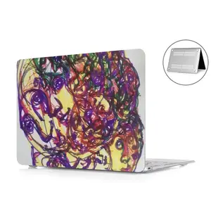 Dizzy MacBook Pro 13 Case