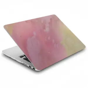 Pink World MacBook Pro 13 Case